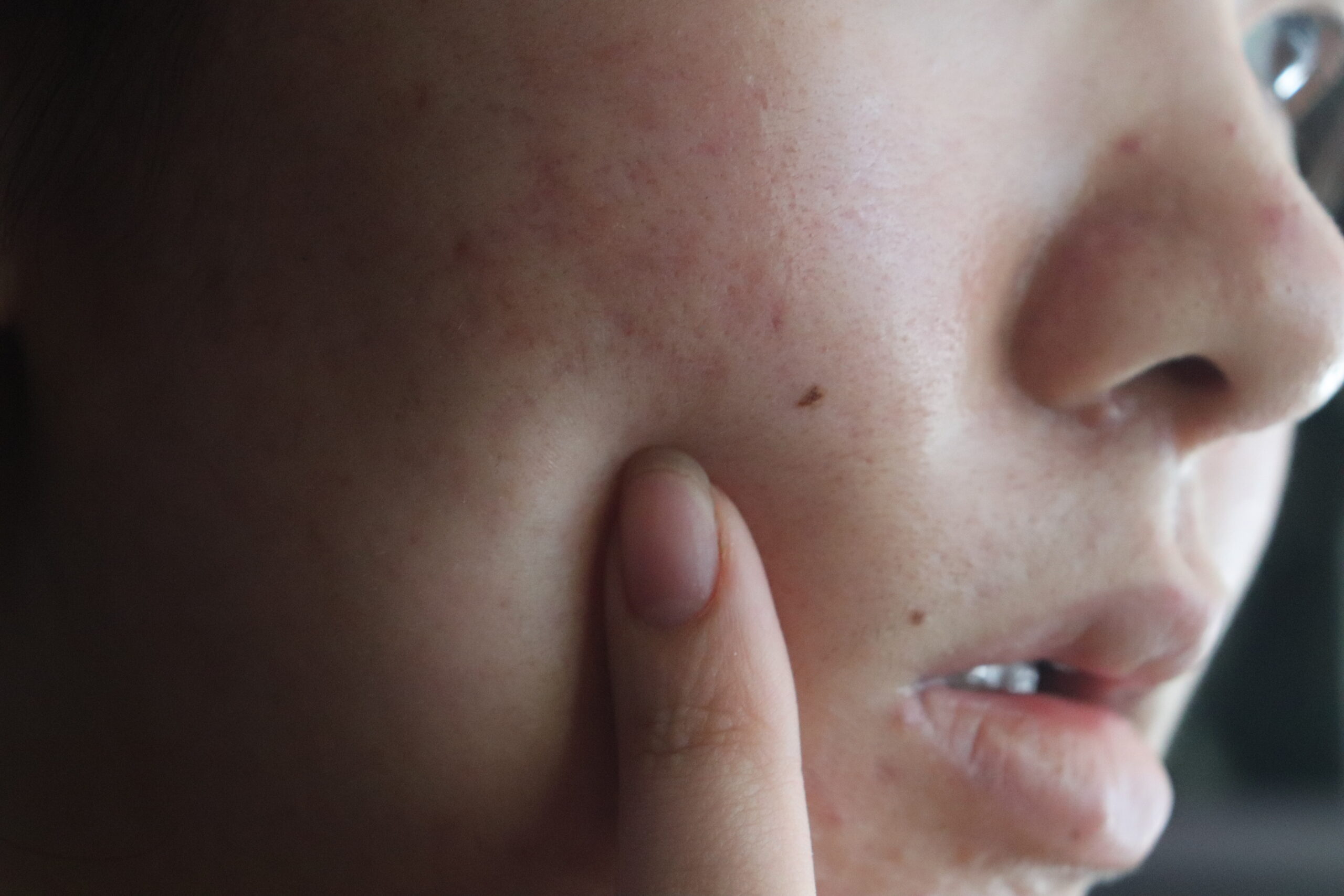 Korean skincare routine